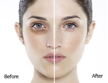  Grand Skin Care – xóa sạch thâm quầng mắt giúp bạn thêm tự tin