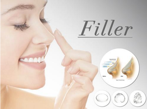 Nâng mũi bằng chất làm đầy Filler