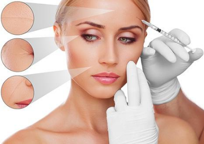 Chất làm đầy Filler dùng để tiêm nâng mũi