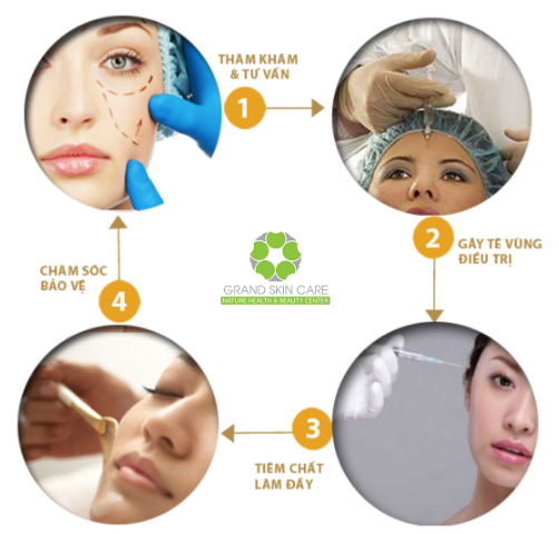 Quy trình nâng mũi không phẫu thuật đơn giản, nhanh chóng và an toàn