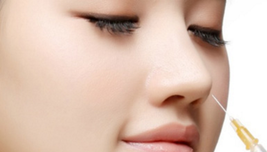  Tiêm mũi cao bẳng thuốc UltraDam là phương pháp thu gọn đầu mũi không cần phẫu thuật